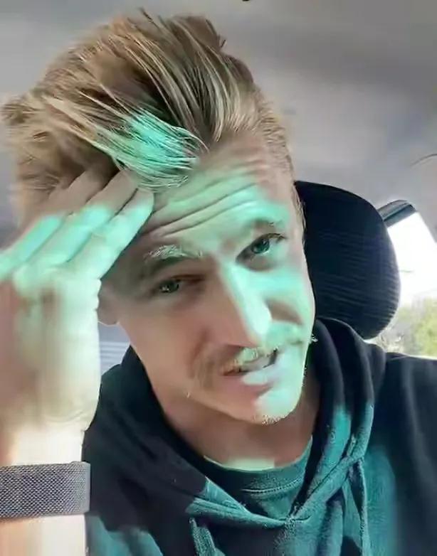 秃头一年不用洗发水头发长出来了,秃头不用洗发水一年后竟长出头发