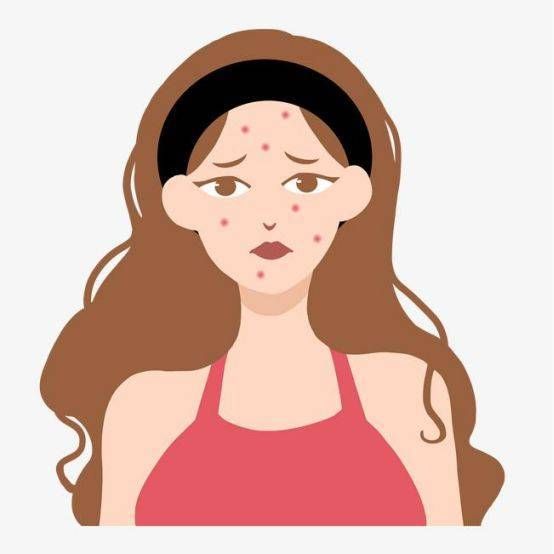 脸上长痘痘需要注意什么,脸上长痘痘应注意事项