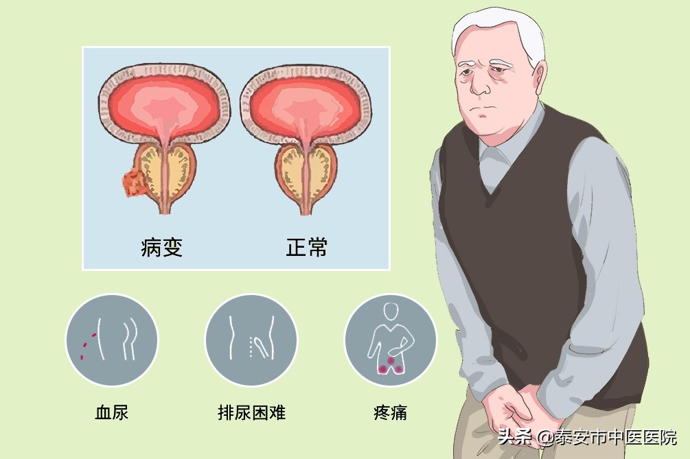 硬核技术治愈患者，用心服务感动患者——*安泰**市中医医院泌尿外科