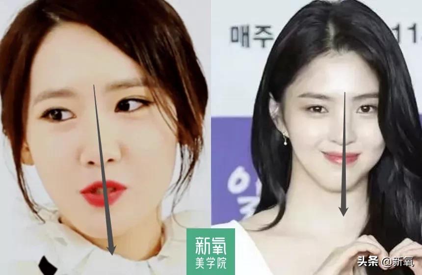 如何知道自己的脸往哪一边歪,怎么知道自己的脸是不是歪的