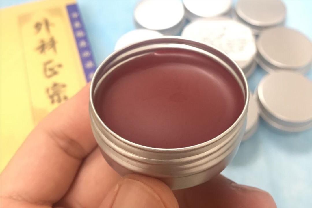 治疗肛裂生肌的药,有没有秘方治疗肛裂的