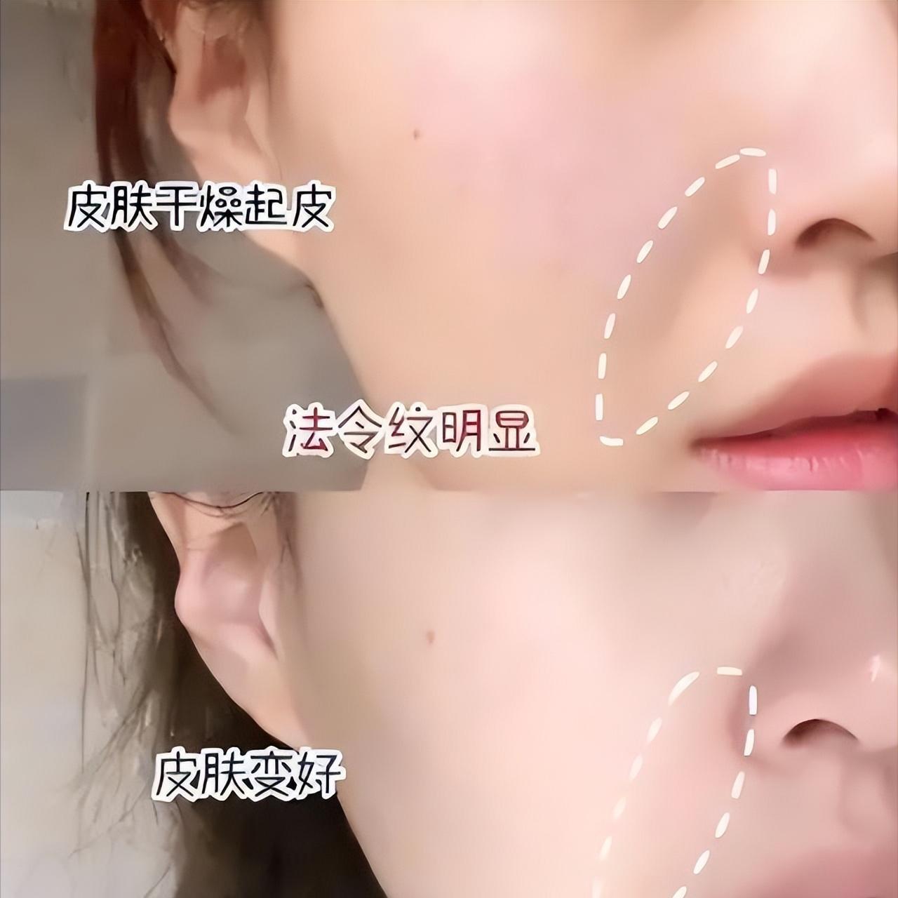 百雀羚补水护肤品哪个最好,百雀羚护肤品怎么样什么档次