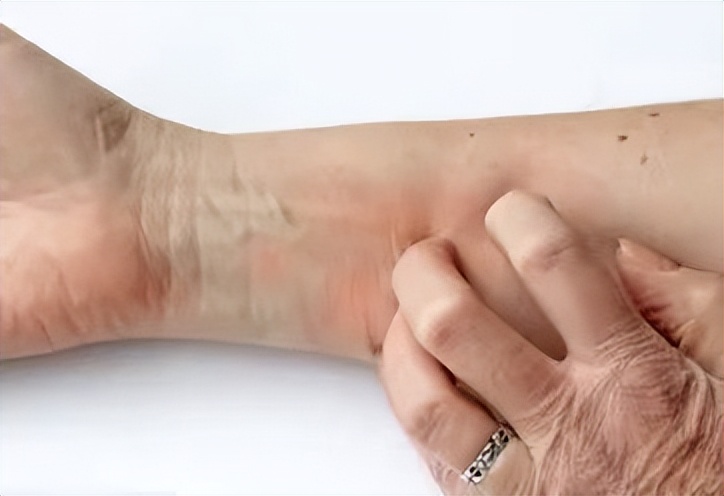 干痒症是什么引起的,身体哪些部位发痒是癌症的征兆