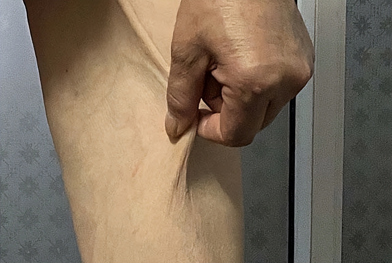 80岁老头艾滋病传染给老婆,艾滋病老年患者应不应该和家人讲