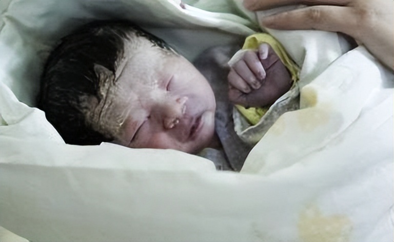 怎么可以让出生的宝宝皮肤白白的,刚出生的宝宝皮肤有哪些情况