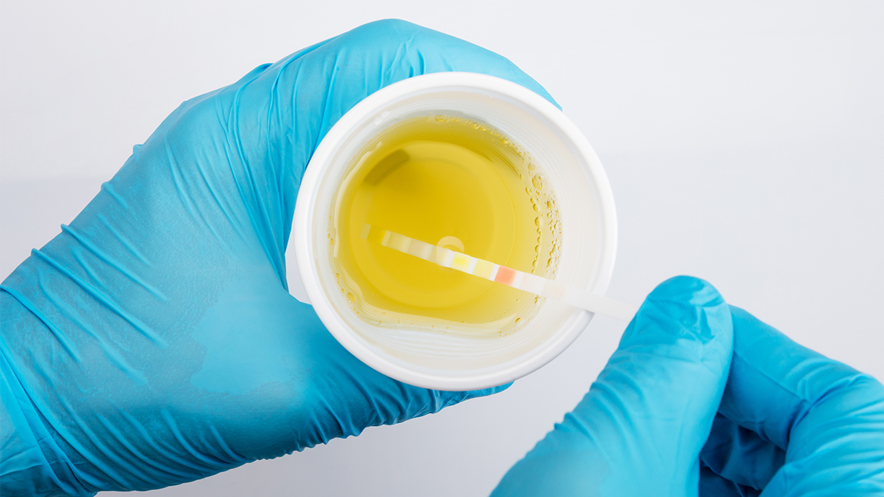 缺钾的症状与补钙的危害,缺钾和缺钙为什么要先补钾