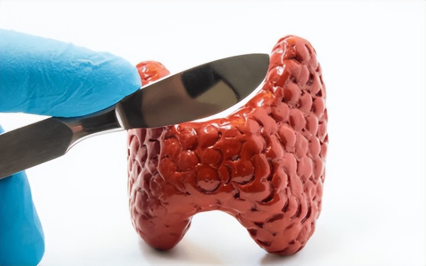 甲状腺结节2mmx2mm需要吃药吗,甲状腺结节4a类是癌吗吃药能好吗