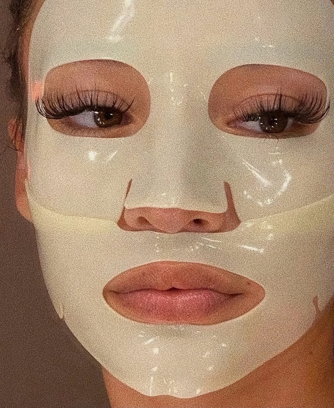 石原里美、Chloe都在用的祛痘、祛痘印方法 你不想知道吗？