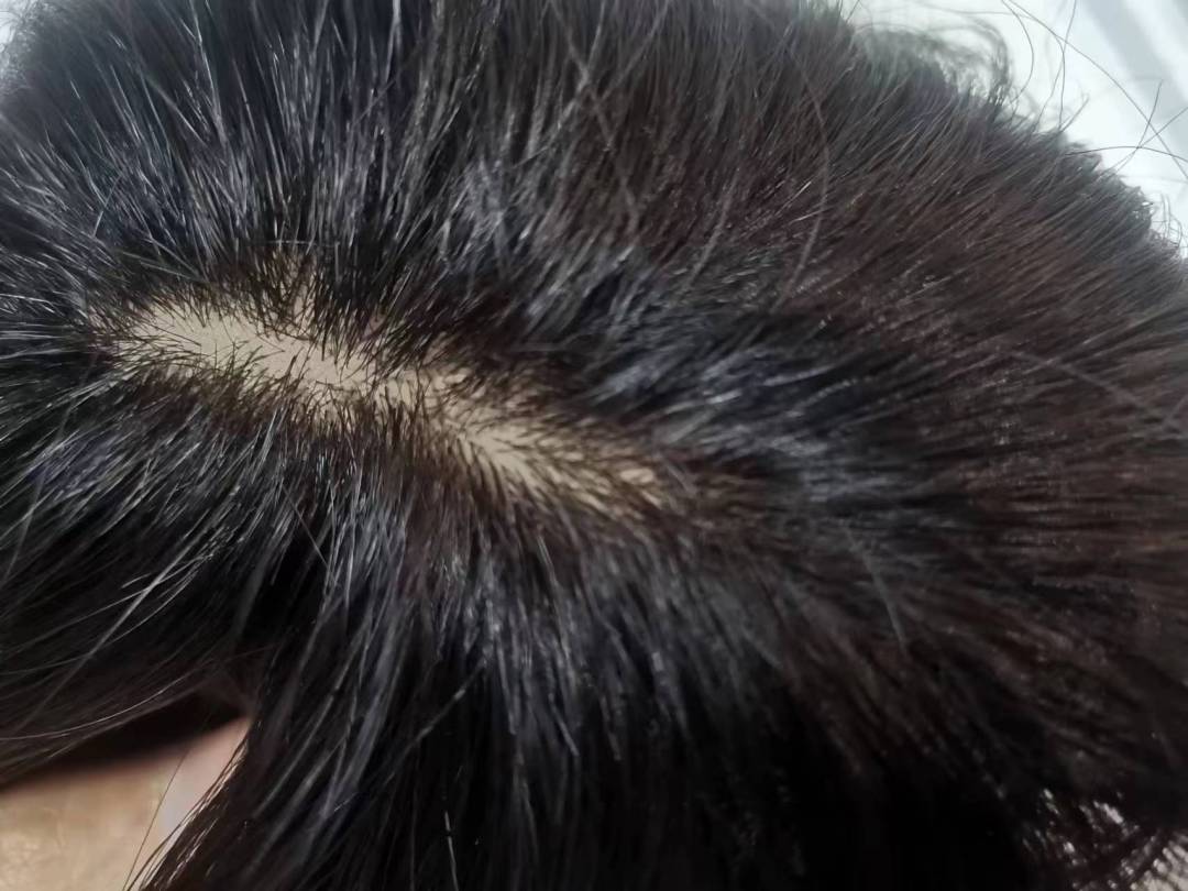 白头发不染可以戴假发吗,假发可以解决白头发的烦恼