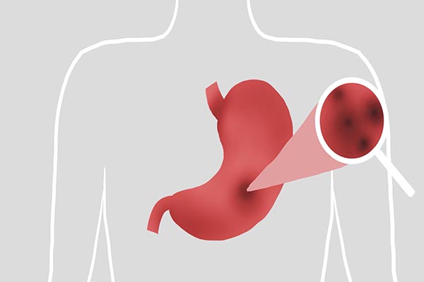 胃不好洋葱可以吃吗,胃不好熟洋葱可以吃吗