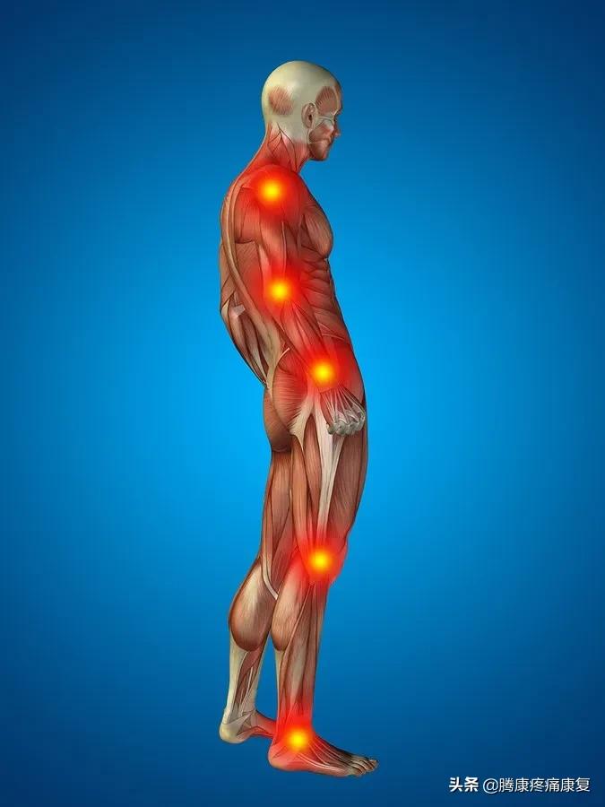 女性左侧软组织疼痛,常见疼痛类型有哪些特点