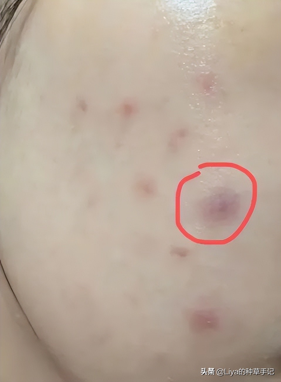 扁平脸如何拯救,扁平脸修复方法图解