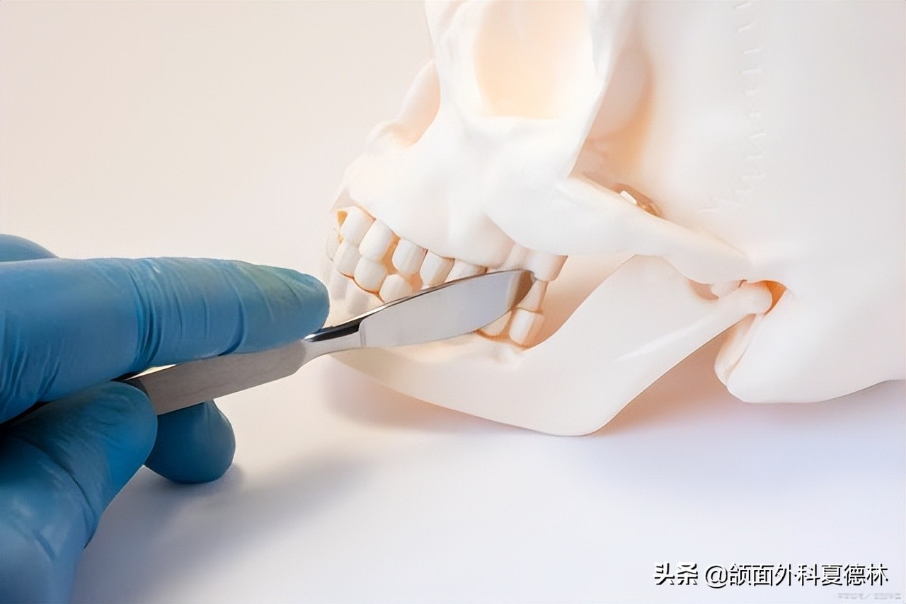 歪下巴正颌手术,颞颌关节紊乱下巴歪复位