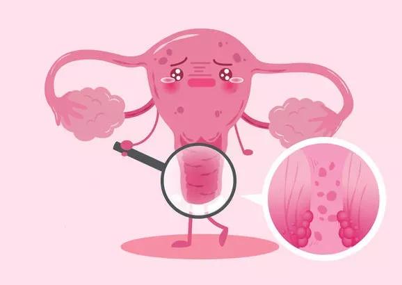 痛经到底能不能吃止痛药,痛经到底该不该吃止痛药缓解呢