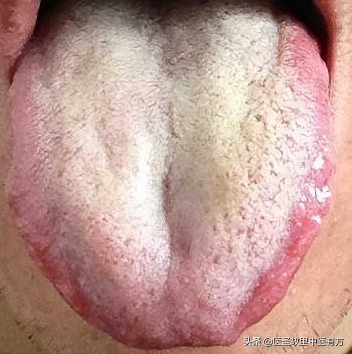 痰湿三味中药克星,治疗痰湿结节包块的一张秘方