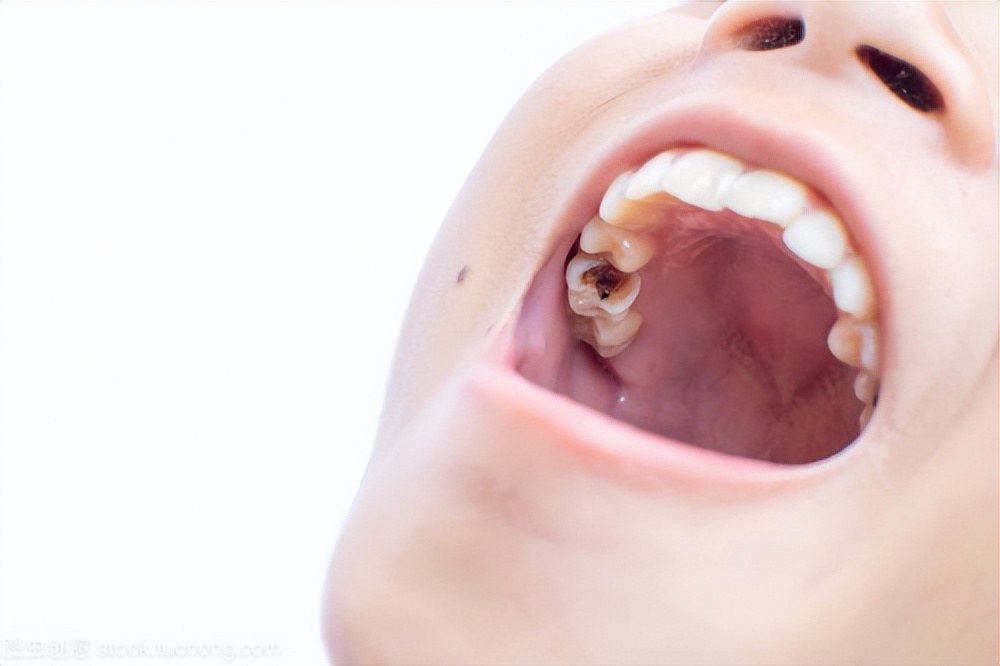 12款热门儿童电动牙刷测评,什么牌子的儿童电动牙刷好测评