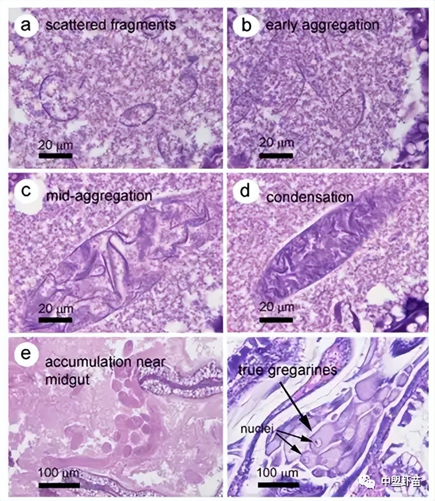 这种虾病，对虾产业产生深远影响！养殖大神揭露该病的今生前世！