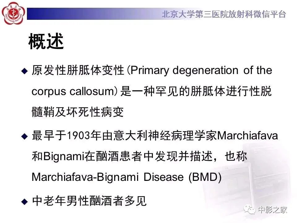 什么叫原发性胼胝体变性,原发性胼胝体变性治疗多少钱