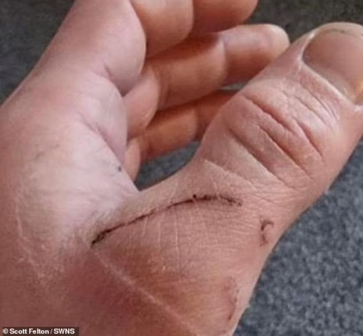 英国嗜血松鼠2天咬伤18人咬到出血!最终被抓起来安乐死