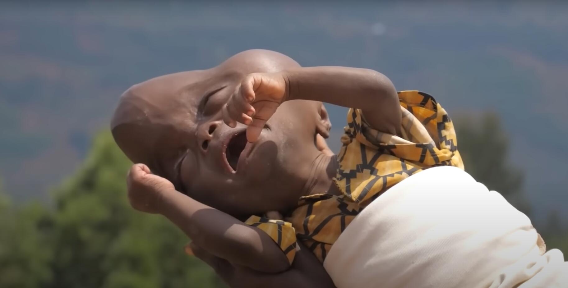 10个难以置信的人类，树皮人、外星人、拥有粗壮手臂的大力水手