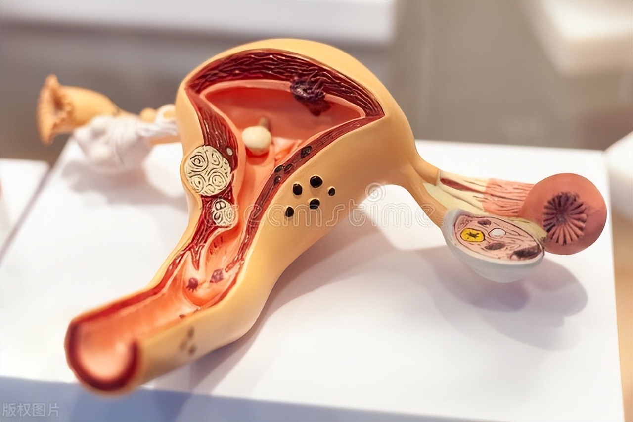 出现这些症状就要注意卵巢健康了,女性身体出现这4个表现要注意了