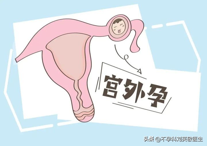 阴道不规律的出血有些什么症状,阴道不正常出血有什么症状