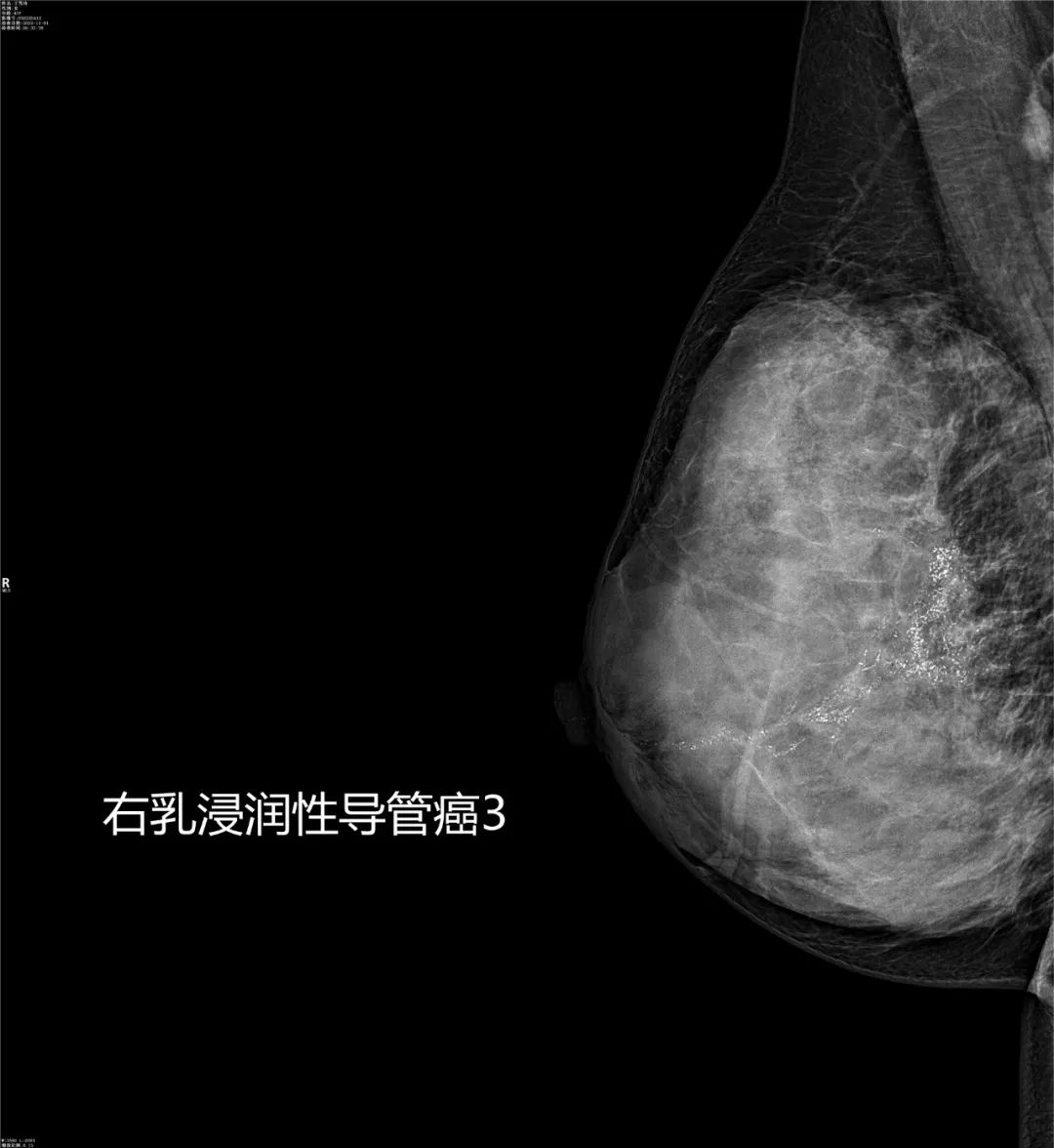 致敬公司的摄影师,美女致敬摄影师视频