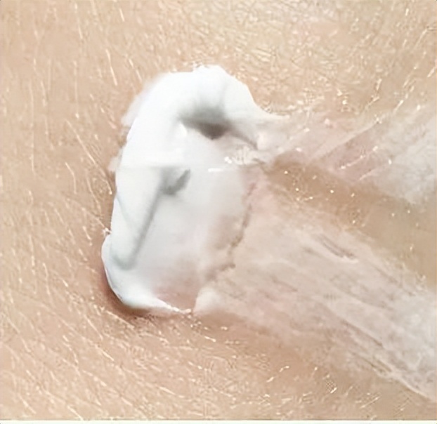 超微小气泡美容有用吗,美容院小气泡