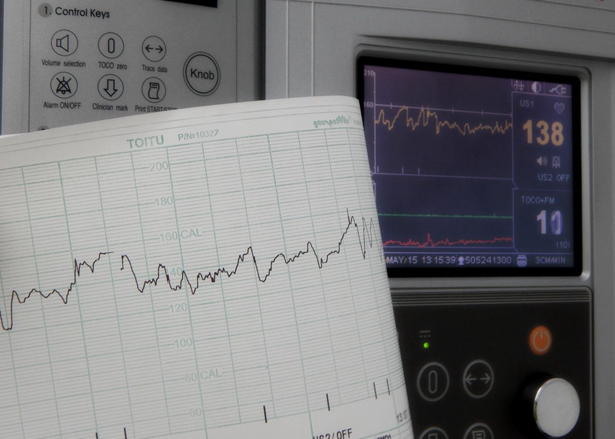 胎心率能辨别胎儿性格吗,看胎心率辨别胎儿有科学依据吗