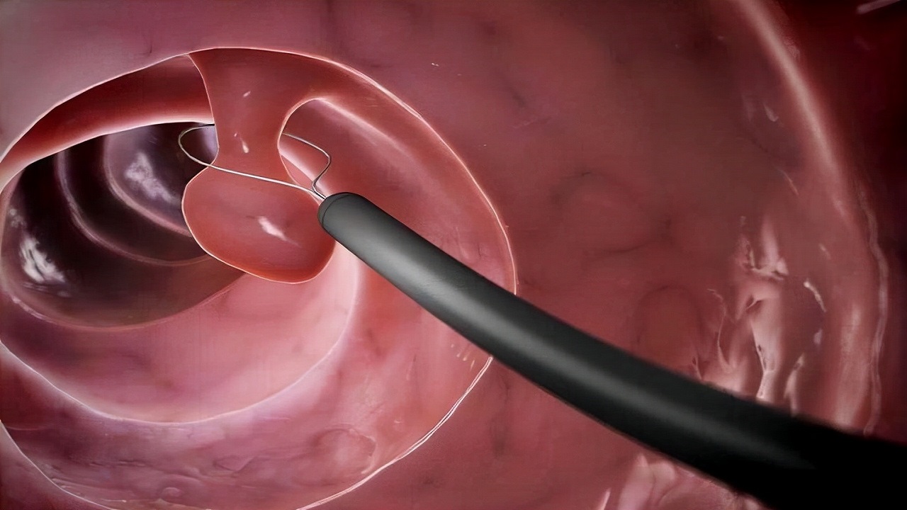 上了年纪也要注意身体,上了年龄身体需要体检