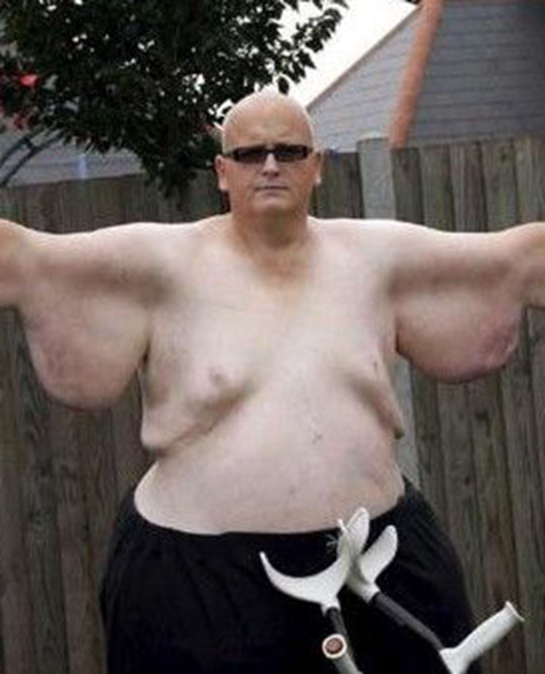 运动减肥后脸部皮肤松弛怎么办,减肥期间怎样能不让脸部皮肤松弛