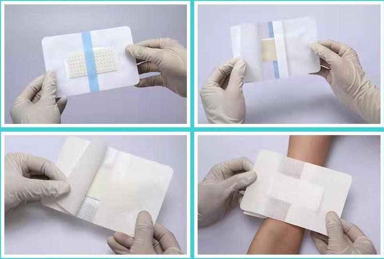 创面护理功能敷料什么作用,医用壳聚糖敷料有什么作用