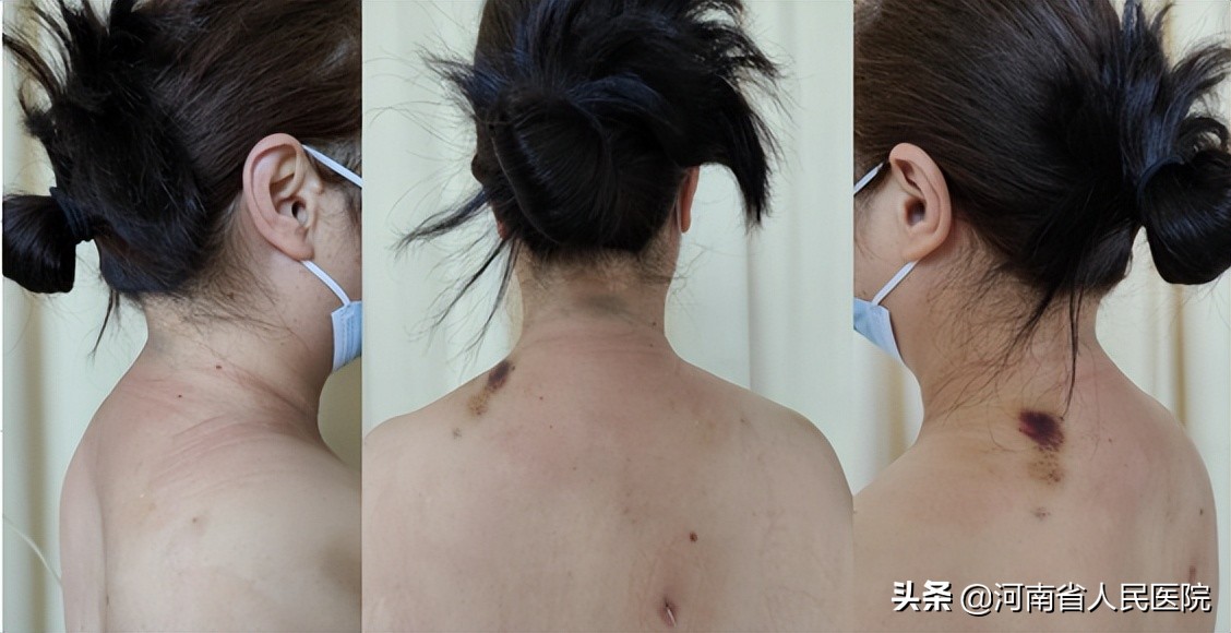 一小时，让她卸下背了十余年的“包袱”