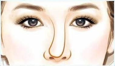 鼻子歪了不通气怎么办,歪鼻矫正改善通气