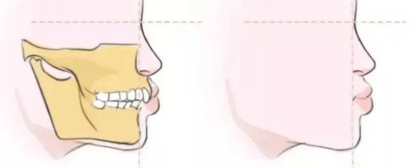 国民初恋毁容了,国民初恋盛世美颜