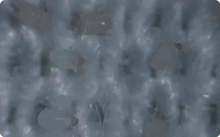 男童眼睛里出现活虫,八岁男孩右眼感染20条虫子