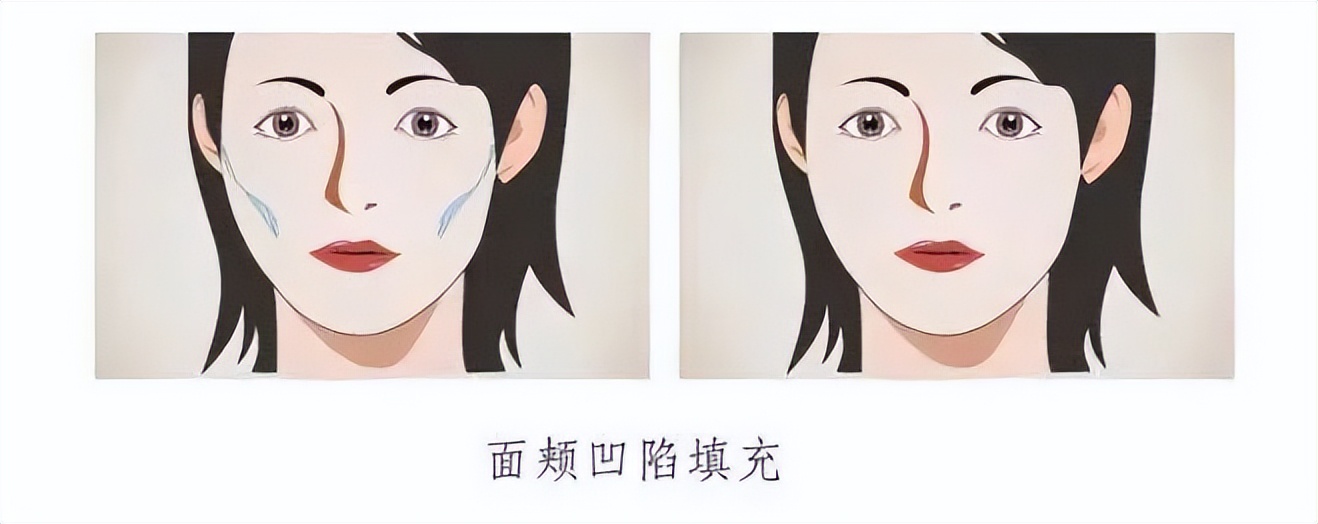 上海九院韦敏轮廓做得好吗,九院韦敏做鼻子好吗