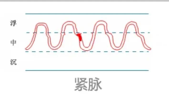 中医28脉诊歌诀及示意图,中医28脉全部脉象图解