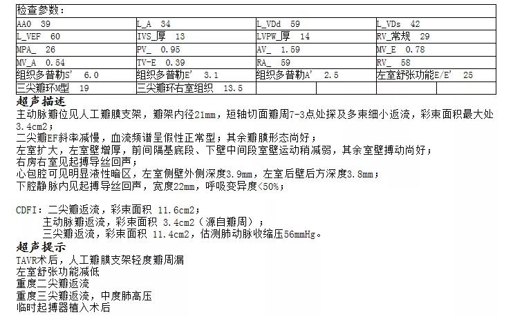 病例回顾与分享,腹膜后血肿介入治疗