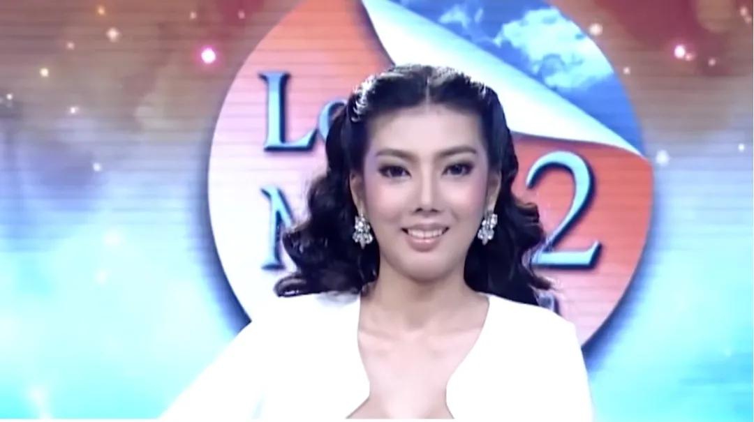 这才是整容存在的意义泰国美女天生没有下巴，整容后迎来全新人生