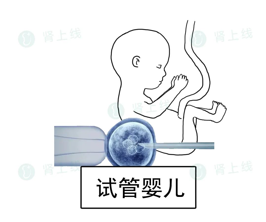 一家接连患尿毒症，是怎么回事？了解最常见的遗传性肾病-多囊肾