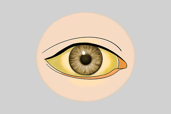 身上有癌的10个皮肤征兆,身体内有癌皮肤有几种表现