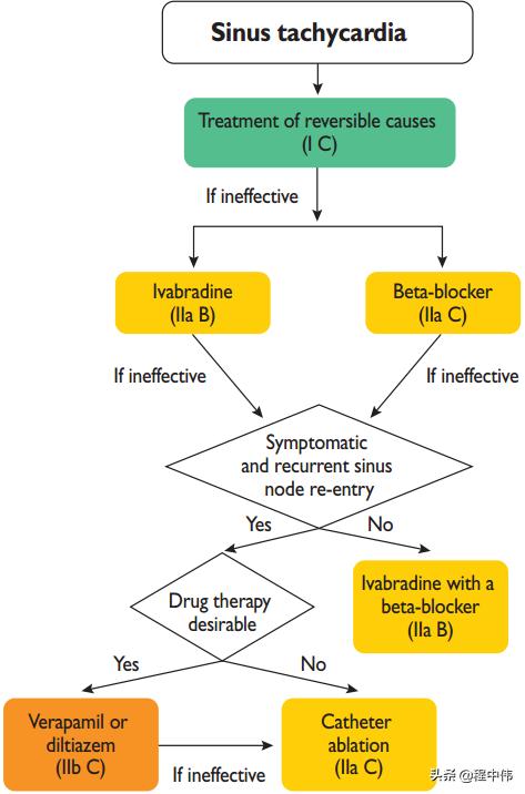 2019ESC室上速处理指南（4）：窦速与局灶房速