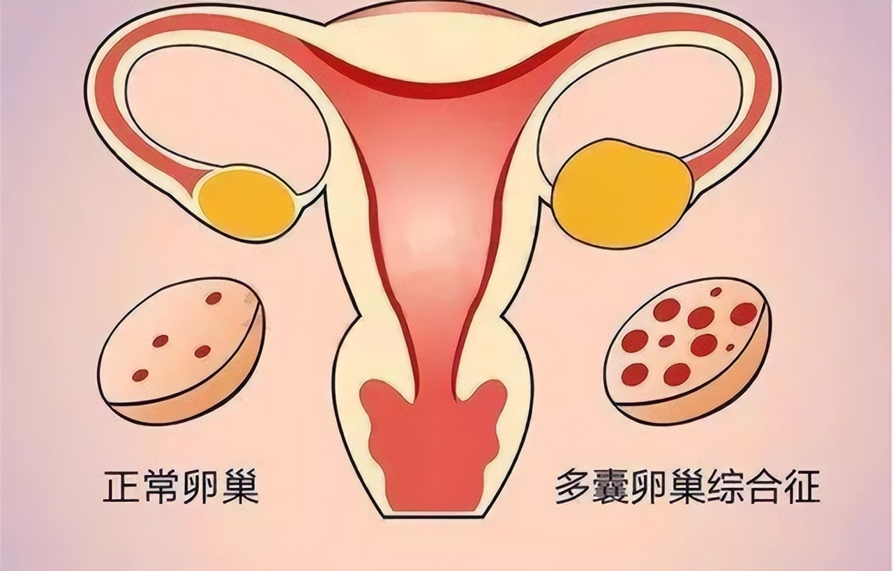 女性体毛生长旺盛与哪些原因有关,关于女性体毛过多的真实原因