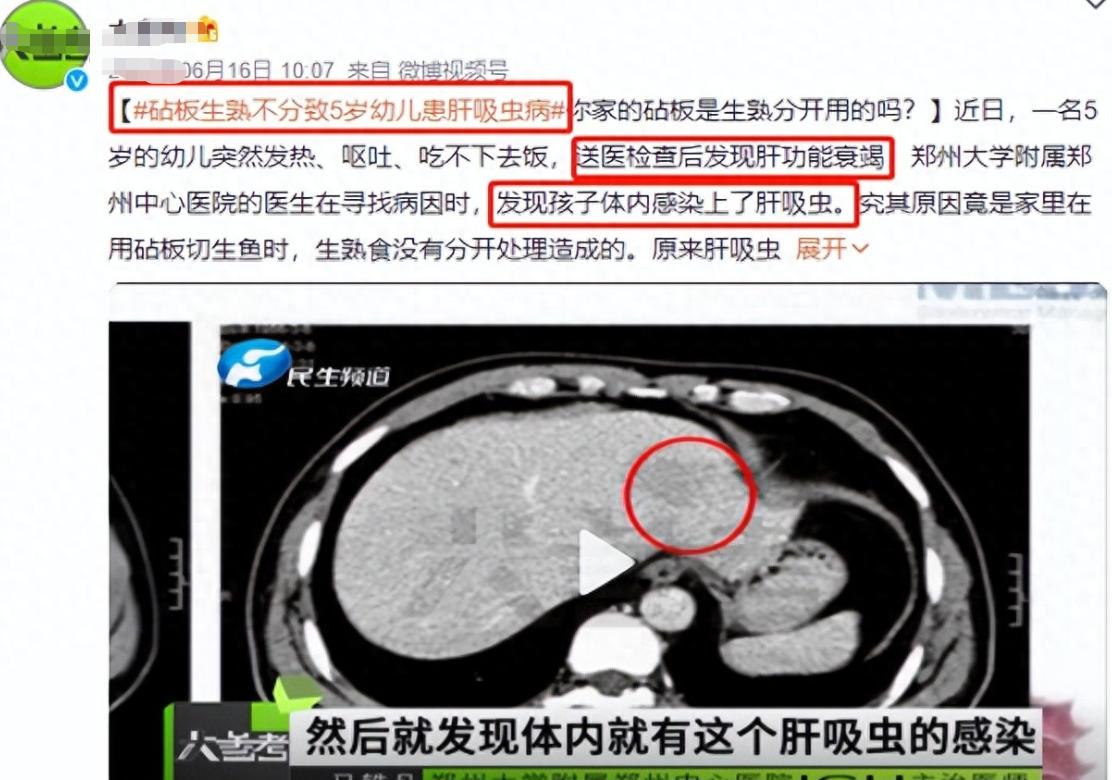 小孩急性肝功能衰竭怎么回事,5岁宝宝高烧呕吐吃什么药