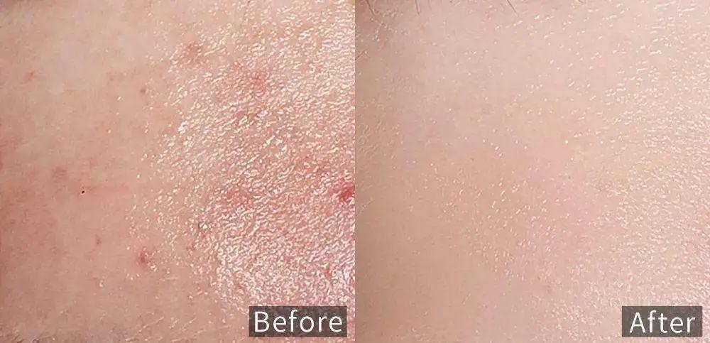 芙荑说成分|视黄醇驾到，干纹细纹全走开