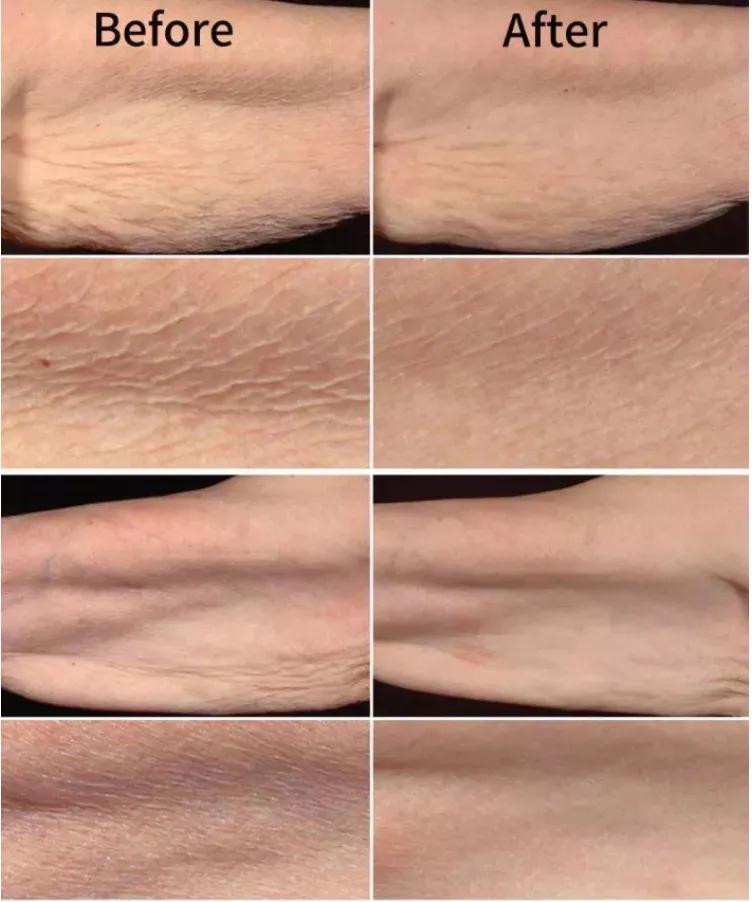 芙荑说成分|视黄醇驾到，干纹细纹全走开