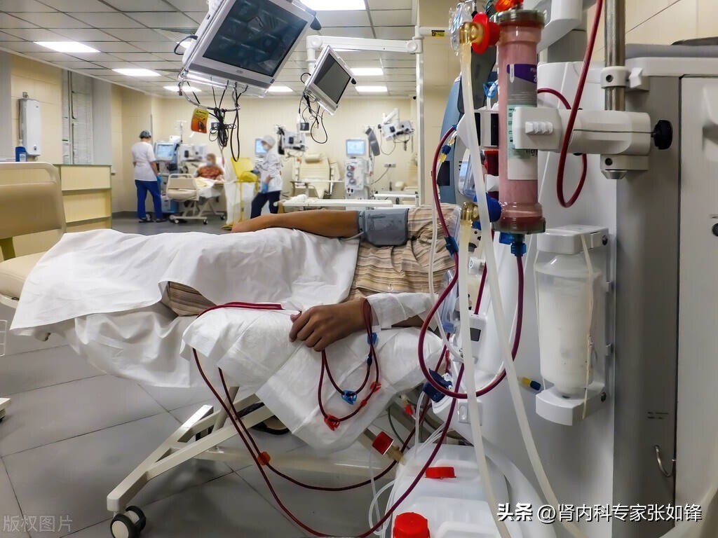 透析患者内瘘堵塞视频,临时管堵塞内瘘又没成熟怎么透析