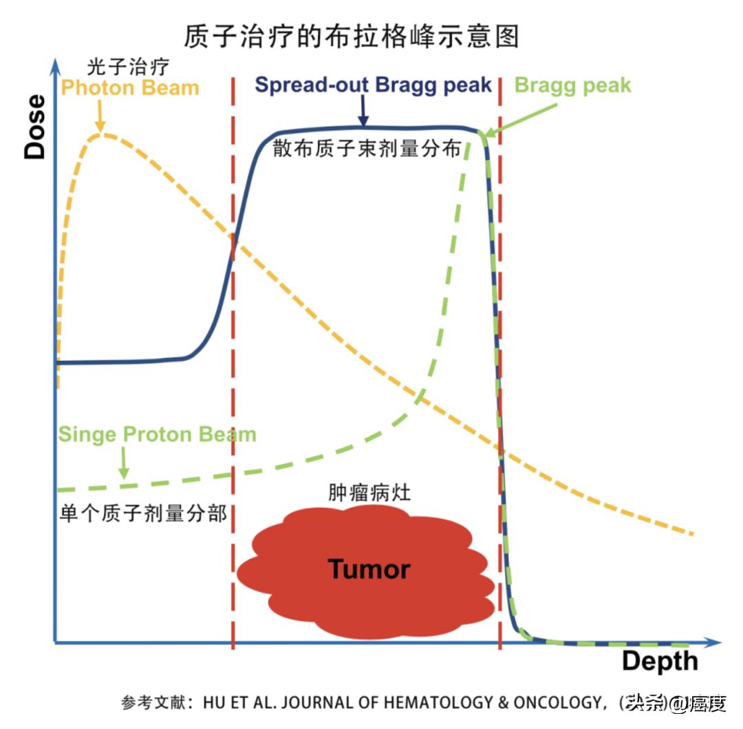 脊索瘤用什么中草药治疗效果好,脊索瘤去日本质子治疗疗效如何