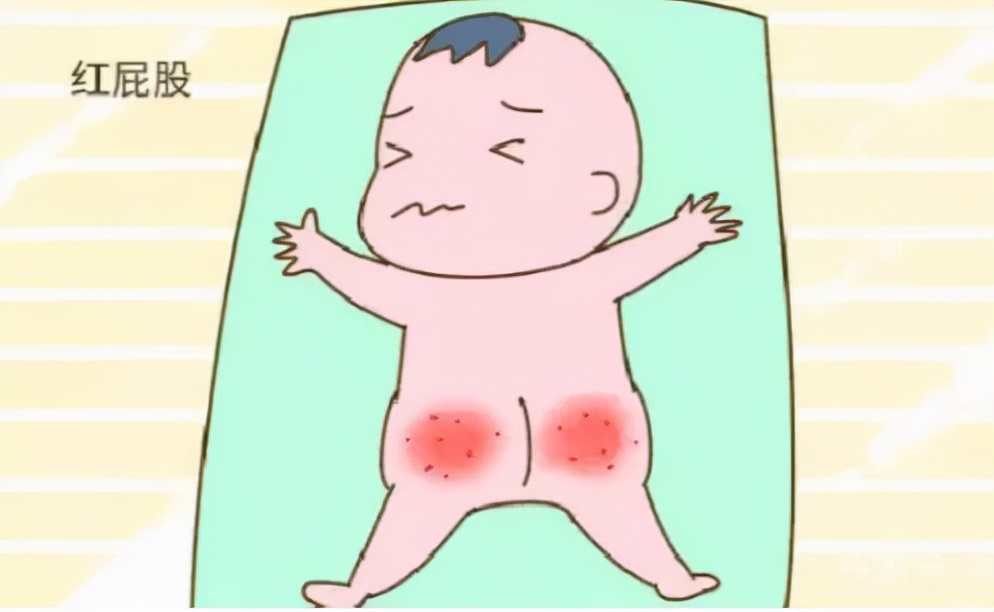 宝宝护臀膏十大品牌排行榜无激素,宝宝护臀膏推荐排行榜前十名贝亲